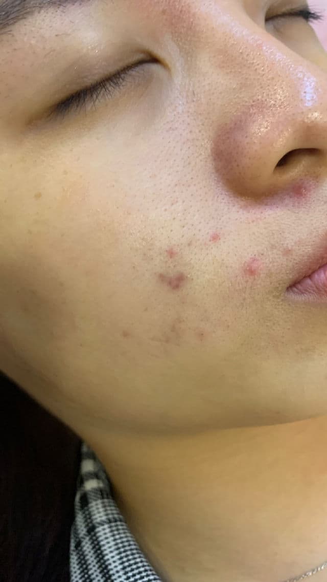 La Roche-Posay Cicaplast Baume B5 Soothing Repairing Balm review photo by FishUnni