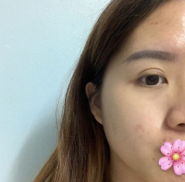 La Roche-Posay Cicaplast Baume B5 Soothing Repairing Balm review photo by FishUnni