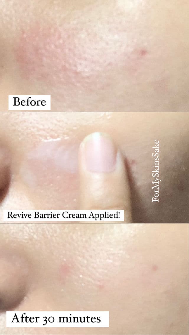 LABORE BiomeRepair Barrier Revive Cream review photo by Formyskinssake