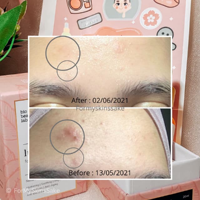 Bio Beauty Lab Luxurious Facial Oil Serum Bio Beauty review photo by Formyskinssake