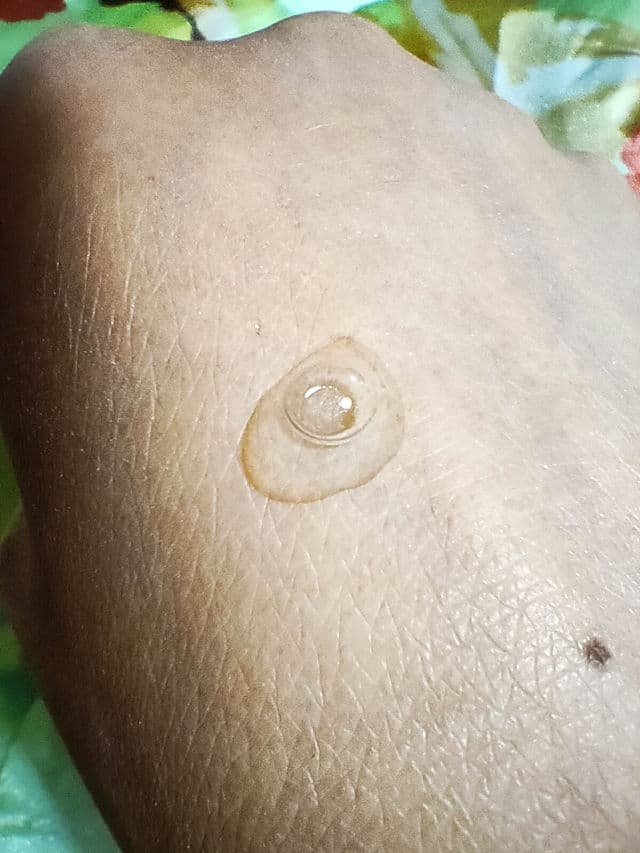 Sebiaclear Micro-Peel product review