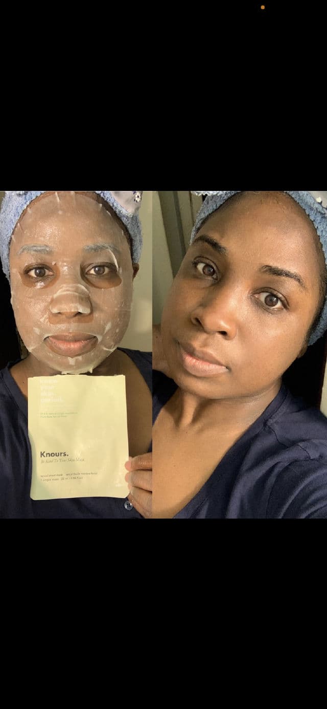 Knours Be Kind To Your Skin Mask review photo by Georgialion47