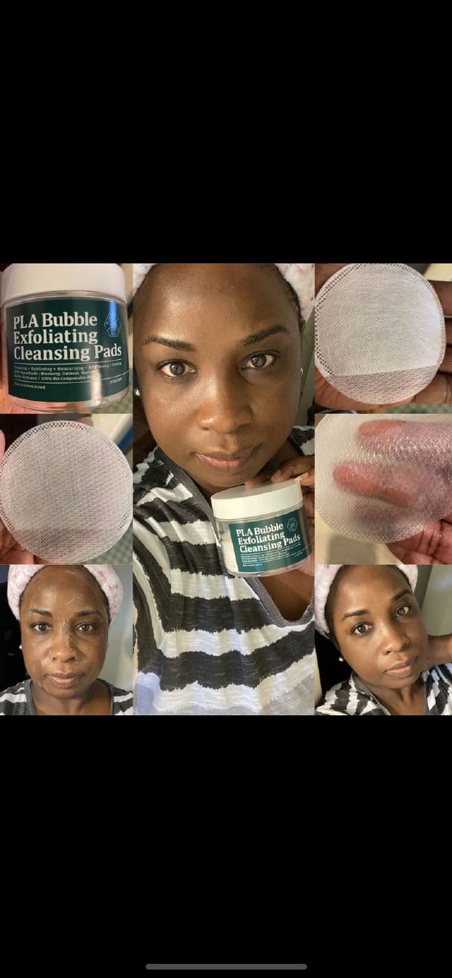 Beautree PLA Bubble Exfoliating Cleansing Pads review photo by Georgialion47