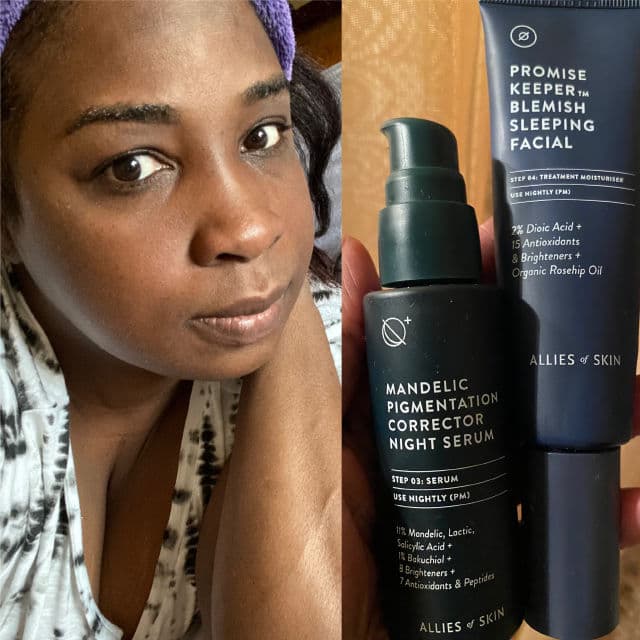 Allies of Skin Promise Keeper Blemish Facial review photo by Georgialion47