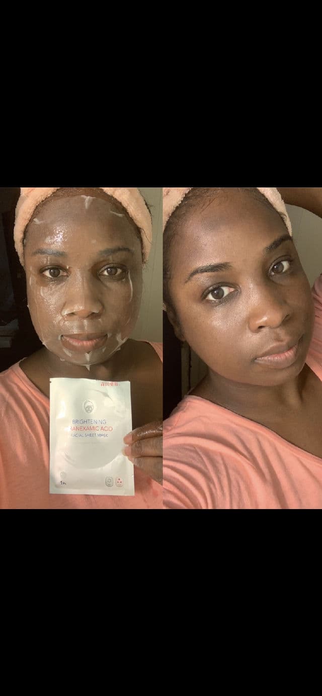 Dr. Morita Brightening Hydrating Facial Sheet Mask Fading Black Spots review photo by Georgialion47