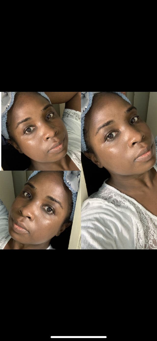 MEDIHEAL N.M.F Intensive Hydrating Mask review photo by Georgialion47