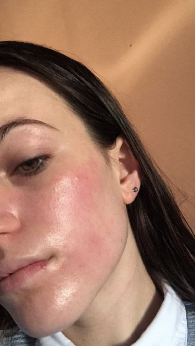 The Inkey List Vitamin C Serum review photo by Grethi