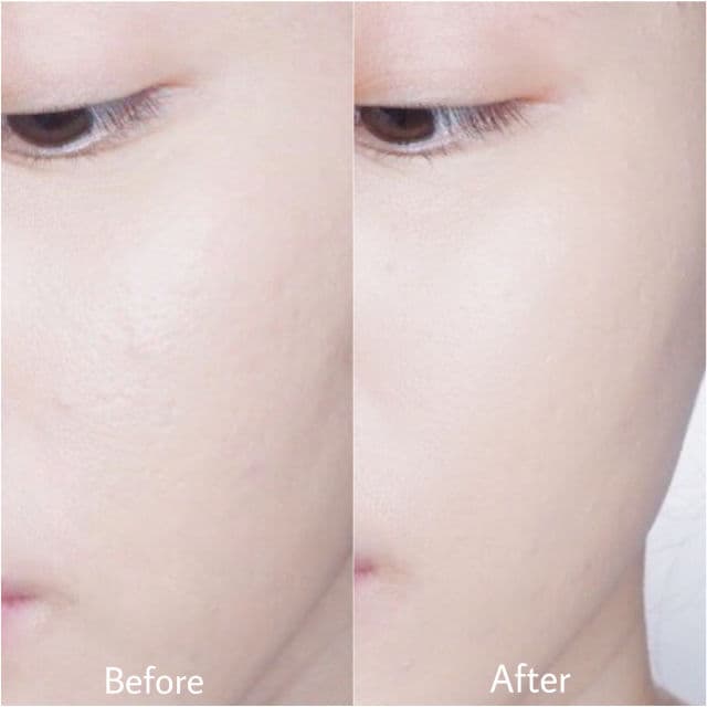 Some By Mi Super Matcha Pore Tightening Serum review photo by Ilovecindtania