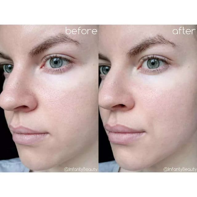 Lapalette Pore Returning Charcoal Mask Form review photo by TanyaKbeauty