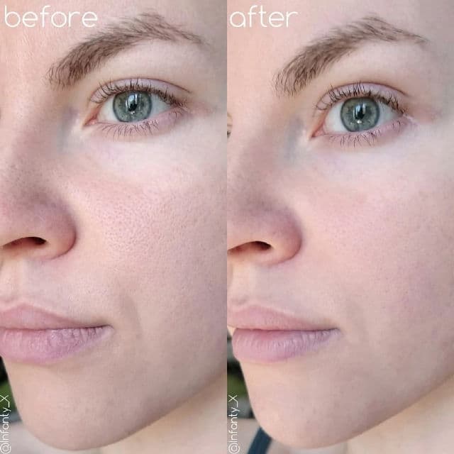 medi-peel Algo-Tox Deep Clear review photo by TanyaKbeauty