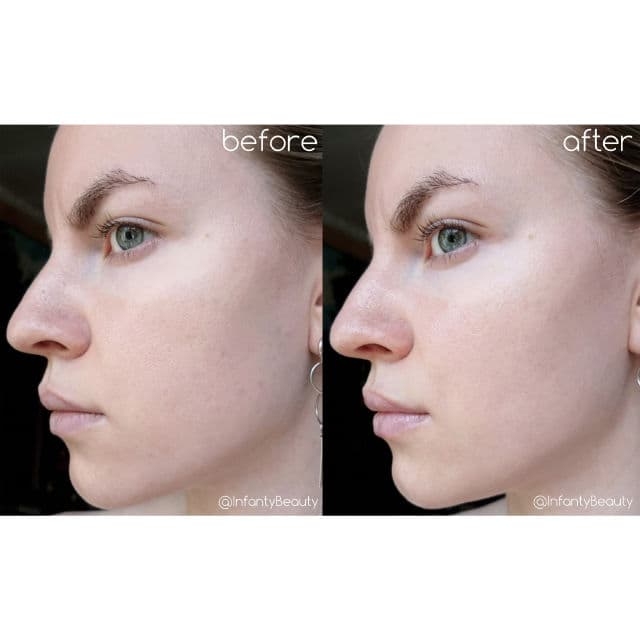 medi-peel Deep VC Ultra Cream review photo by TanyaKbeauty