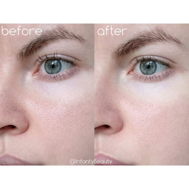medi-peel Pore 9 Tightening Serum review photo by TanyaKbeauty