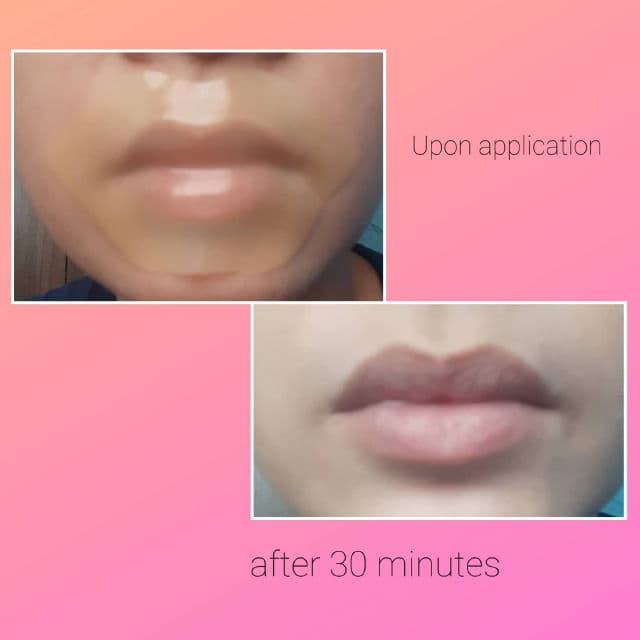 PURE SMILE Choosy Lip Pack review photo by IvyPedrozo