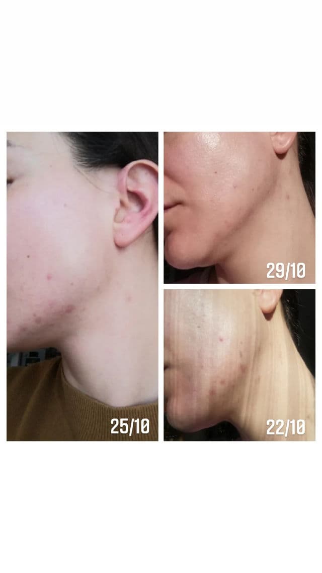 BEAUTY OF JOSEON Glow Serum Propolis + Niacinamide review photo by Ivyloveskincarestuff