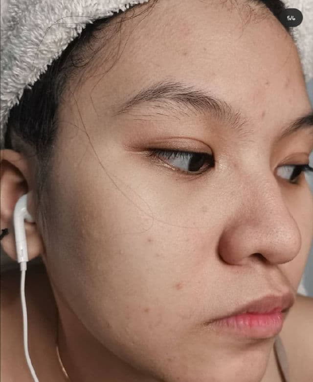 SECRET KEY Starting Treatment Eye Cream Rose Edition review photo by Jhoannaaxx