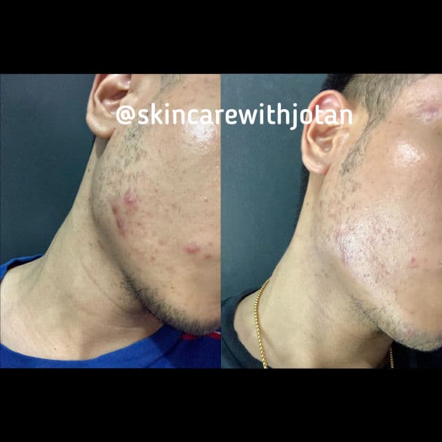 Pratista Retinoid Night Cream review photo by Jotan