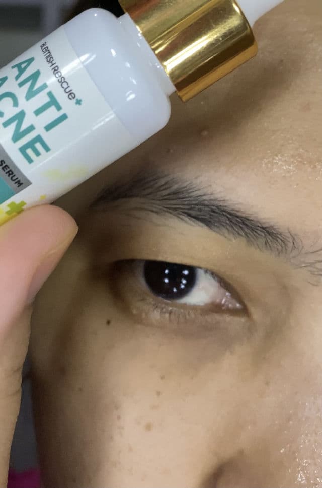 Azarine Anti Acne & Brightening Serum  review photo by JuliaAlly