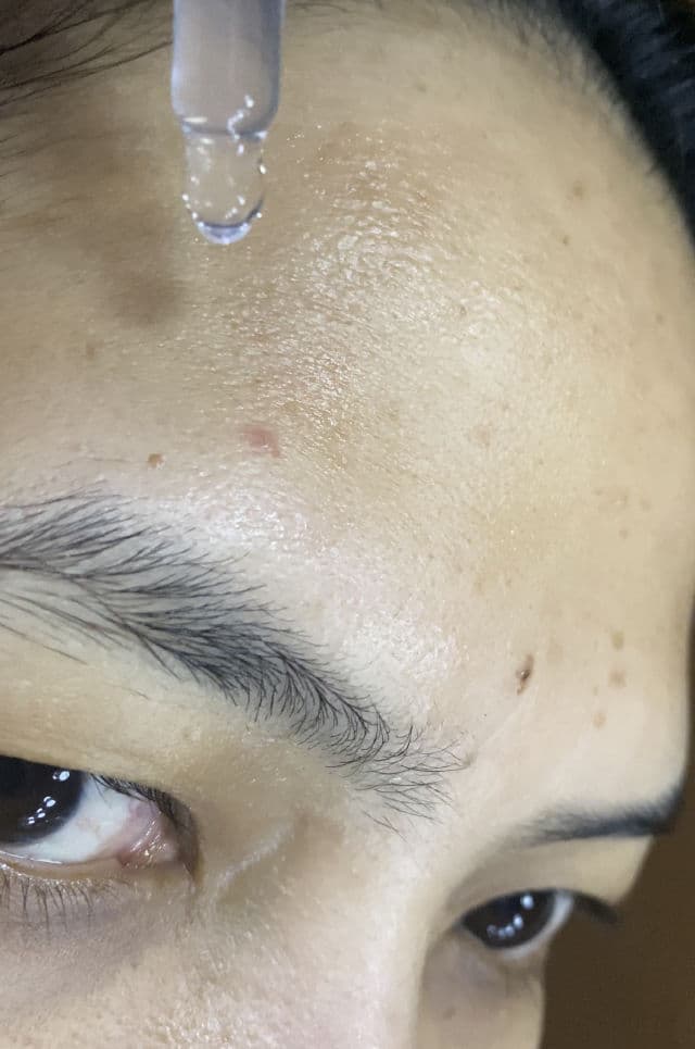 Azarine Anti Acne & Brightening Serum  review photo by JuliaAlly