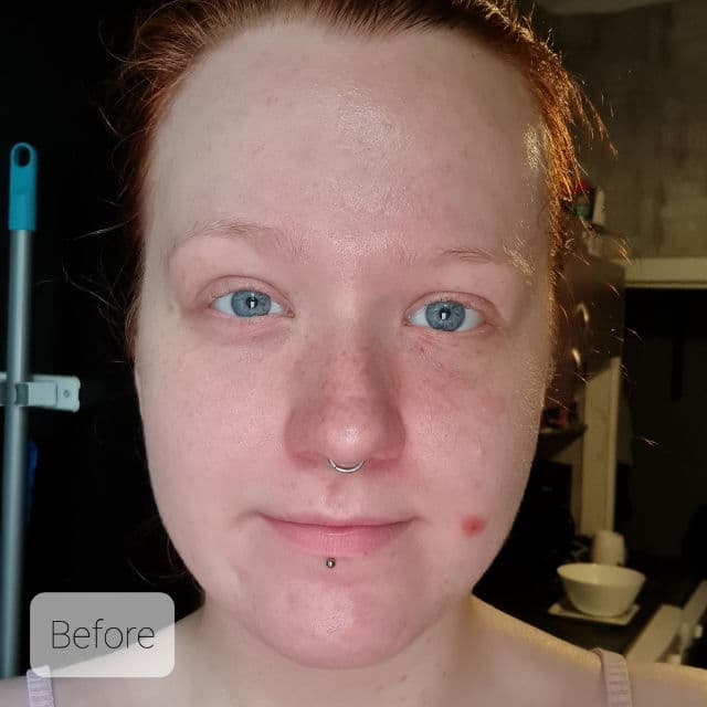 Balea Med Ultra Sensitive Beruhigendes Intensiv Serum review photo by KHHLuv