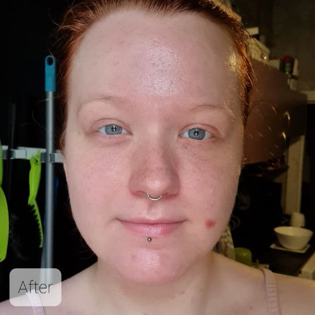 Balea Med Ultra Sensitive Beruhigendes Intensiv Serum review photo by KHHLuv