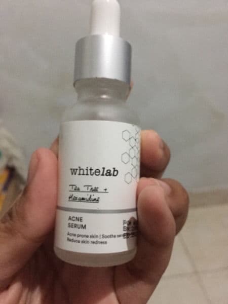 whitelab Acne Serum review photo by Kalpika