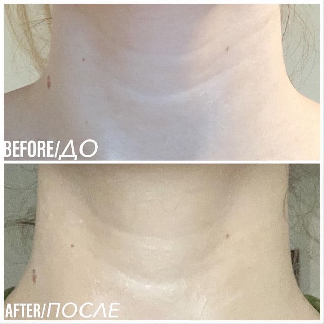 Avajar Perfect Neck Age Wrinkle Control Mask review photo by Katerynabeauty