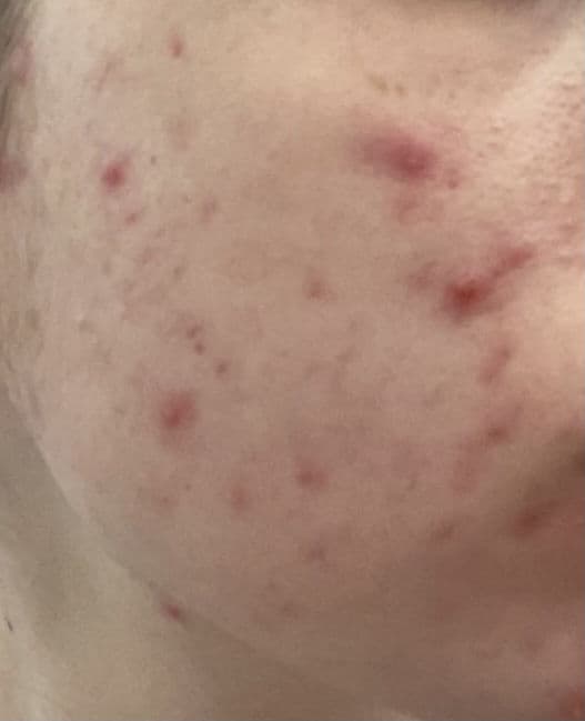 CeraVe Hydrating Cream-to-Foam Cleanser review photo by Kayleighskin