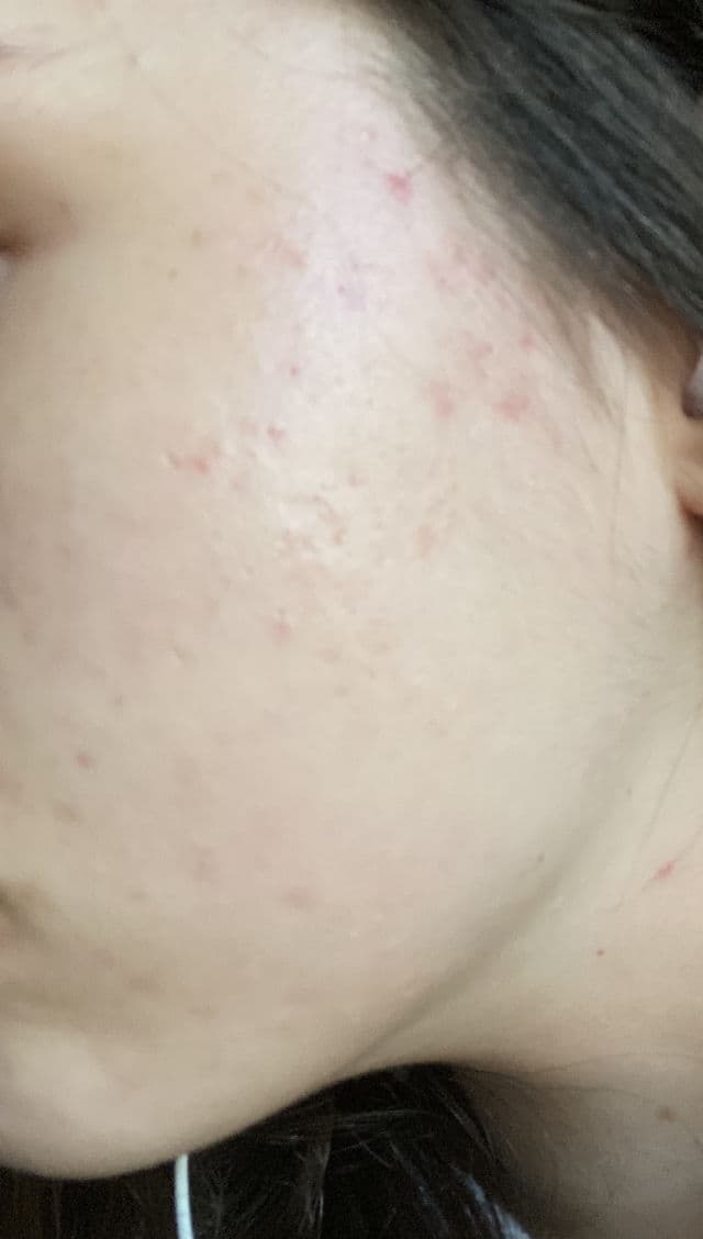 CeraVe Hydrating Cream-to-Foam Cleanser review photo by Kayleighskin