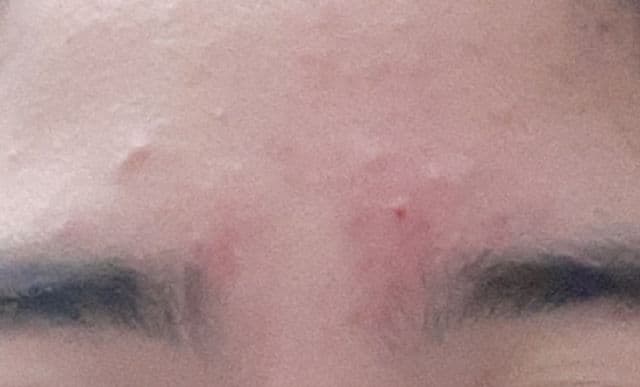 whitelab Peeling Serum AHA BHA PHA review photo by Lalalynn