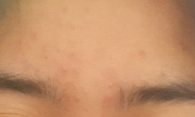 whitelab Peeling Serum AHA BHA PHA review photo by Lalalynn