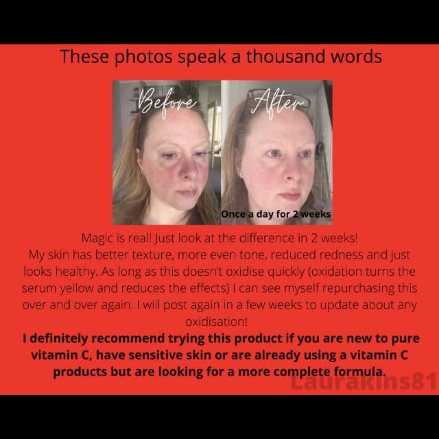 By WISHTREND [Discontinued] Pure Vitamin C 15% with Ferulic Acid review photo by LauraG