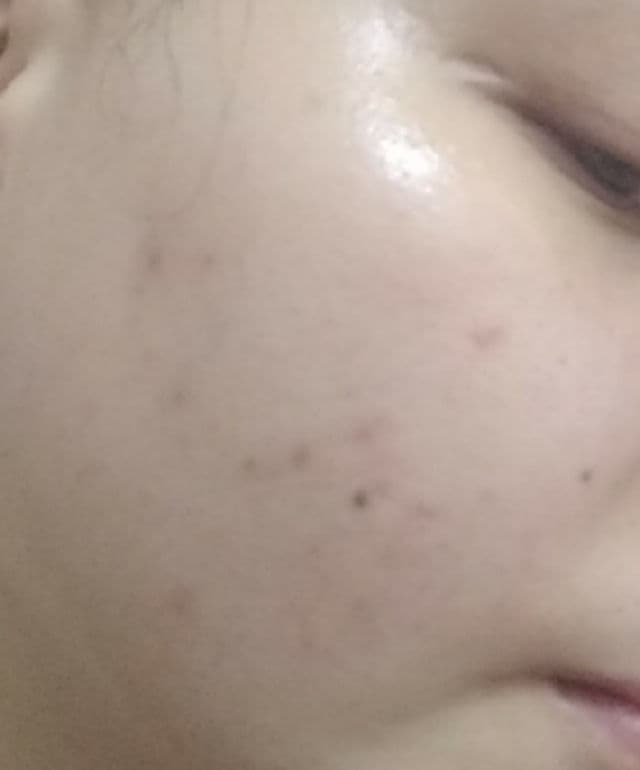 Rohto Mentholatum Melano CC Intensive Anti-Spot Essence review photo by Leovine
