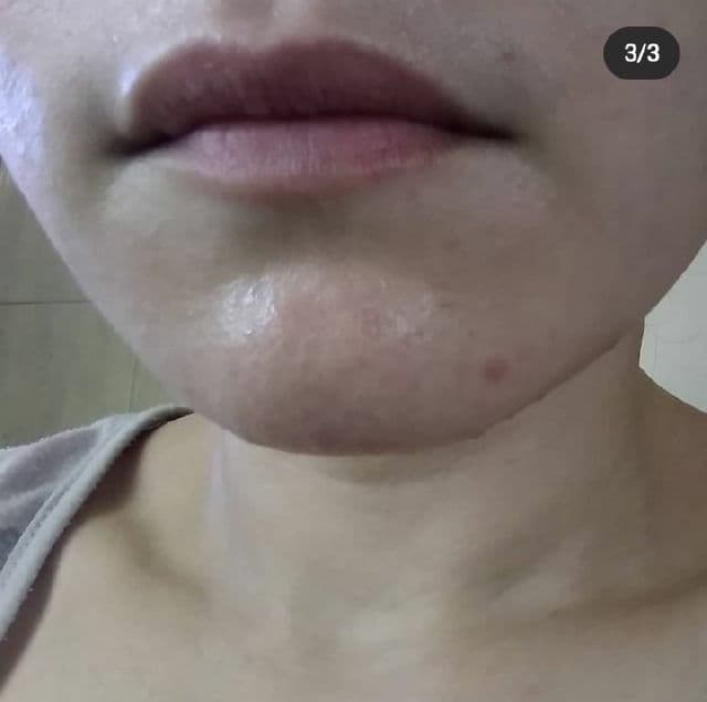 Avajar Perfect V Lifting Mask review photo by Littledarling27