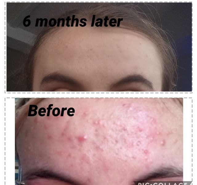 SheaMoisture African Black Soap And Charcoal Detoxifying Gel Cleanser review photo by MeganRia
