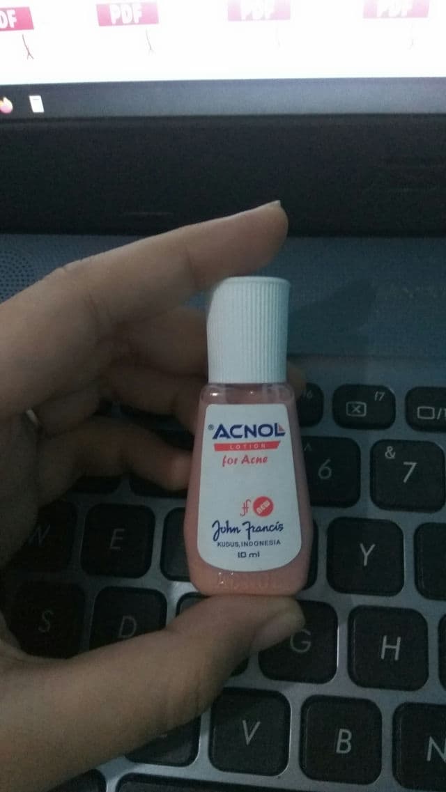 Acnol Lotion for Acne review photo by Meivita28