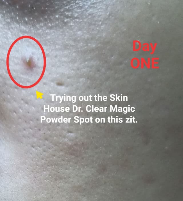 The Skin House Dr. Clear Magic Powder Spot review photo by Miss_LunaYee