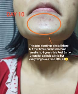 review