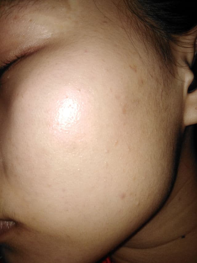 SKIN1004 [Discontinued] Madagascar Centella Asiatica 100 Ampoule (100ml) review photo by Mustbpretty