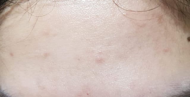 ANUA Heartleaf 80% Soothing Ampoule review photo by Peaches7
