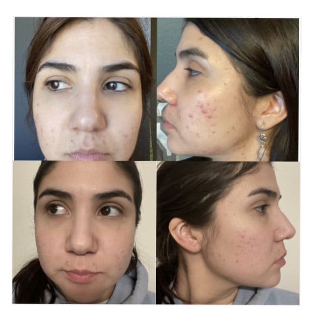 Curology Base Formula review photo by Vmh481