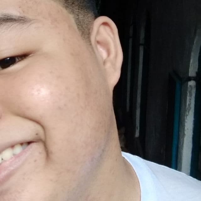 Dr. S. Wong's Lightening System Soap review photo by skincarewithian