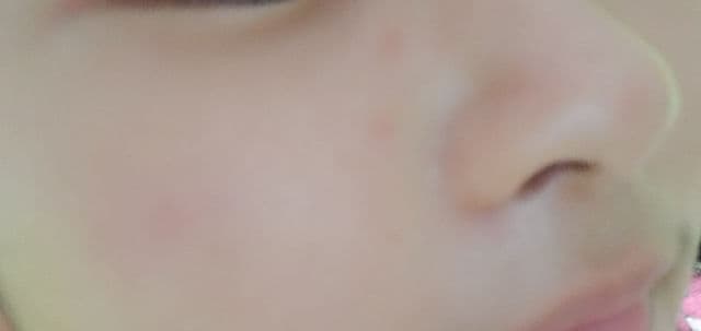 Acnes Acnes Spot Clear Gel review photo by PickyLawviee