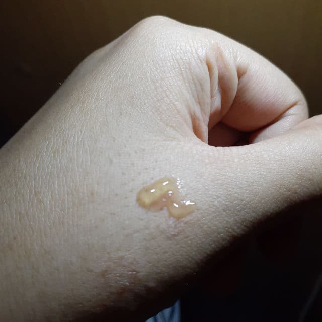 Emina Ms. Pimple Acne Solution Spot Gel review photo by Ranimutiaraa