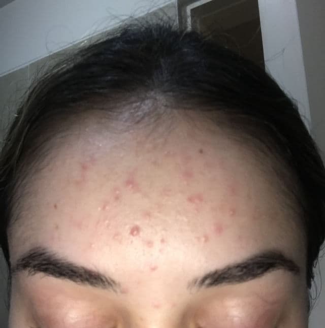 Neutrogena Oil-Free Acne Wash Pink Grapefruit Foaming Scrub review photo by Romiroro