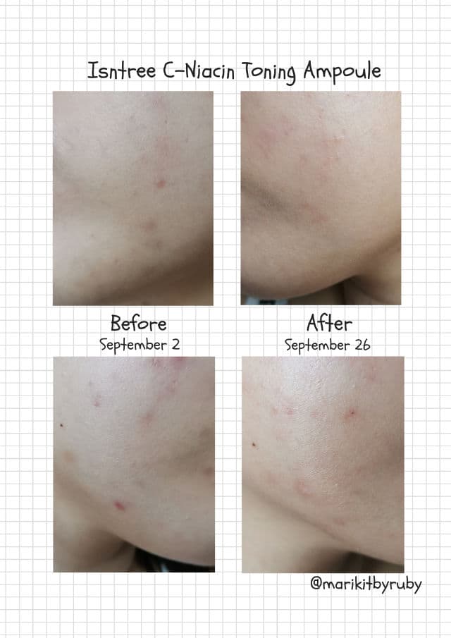 ISNTREE C-Niacin Toning Ampoule review photo by Ruby