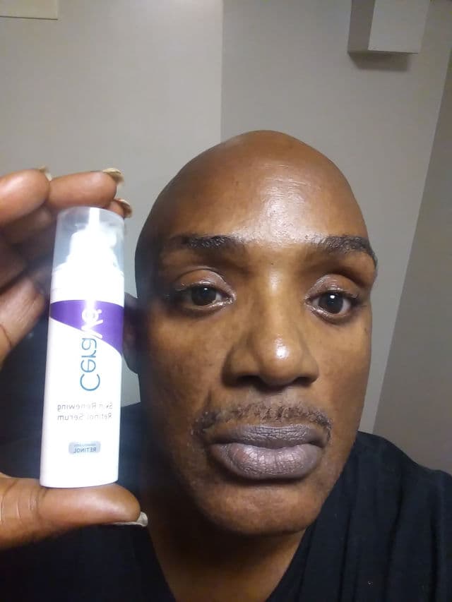 CeraVe Skin Renewing Retinol Serum review photo by Rudymccoy