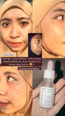 review