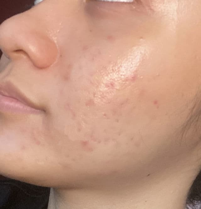 COSRX Salicylic Acid Daily Gentle Cleanser review photo by Sharonn