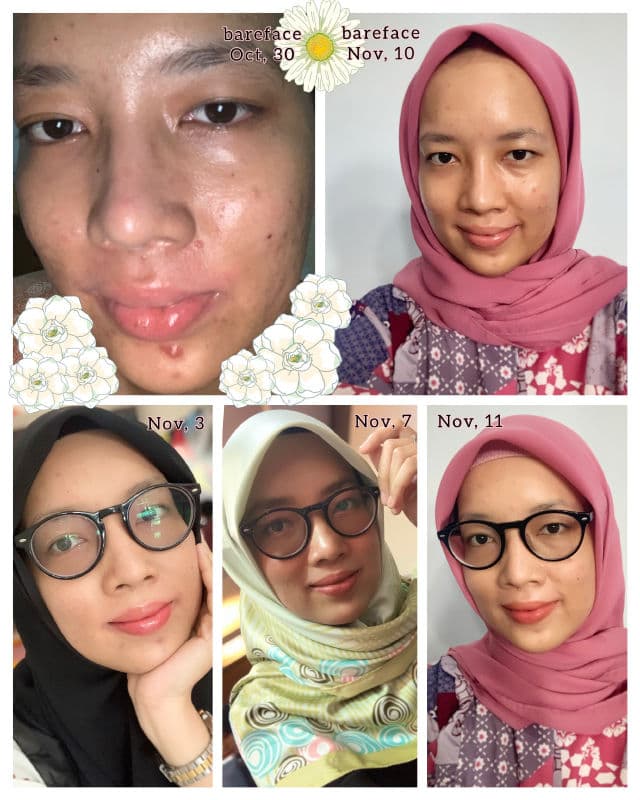 COMMONLABS Vitamin E Calming Light Cream review photo by Siitha