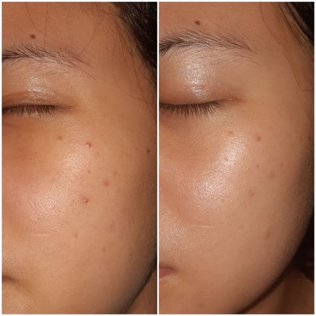Indoganic Bakuchiol Intensive Face Oil review photo by Skincarediaryy
